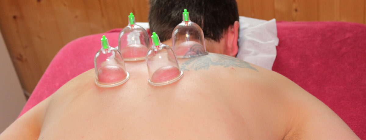 Medizinische Massage mit Einsatz von Schröpfgläsern